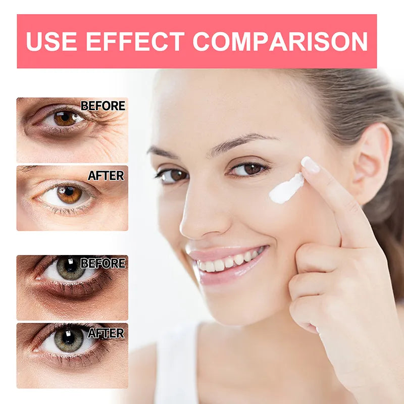 Anti Aging Lifting Firming Retinol Anti-Wrinkle Eye Cream Remove Eye Bags Dark Circles Whitening Moisturizing Brighten Skin Care